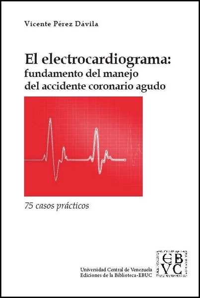 El electrocardiograma: Fundamento del manejo del accidente coronario agudo