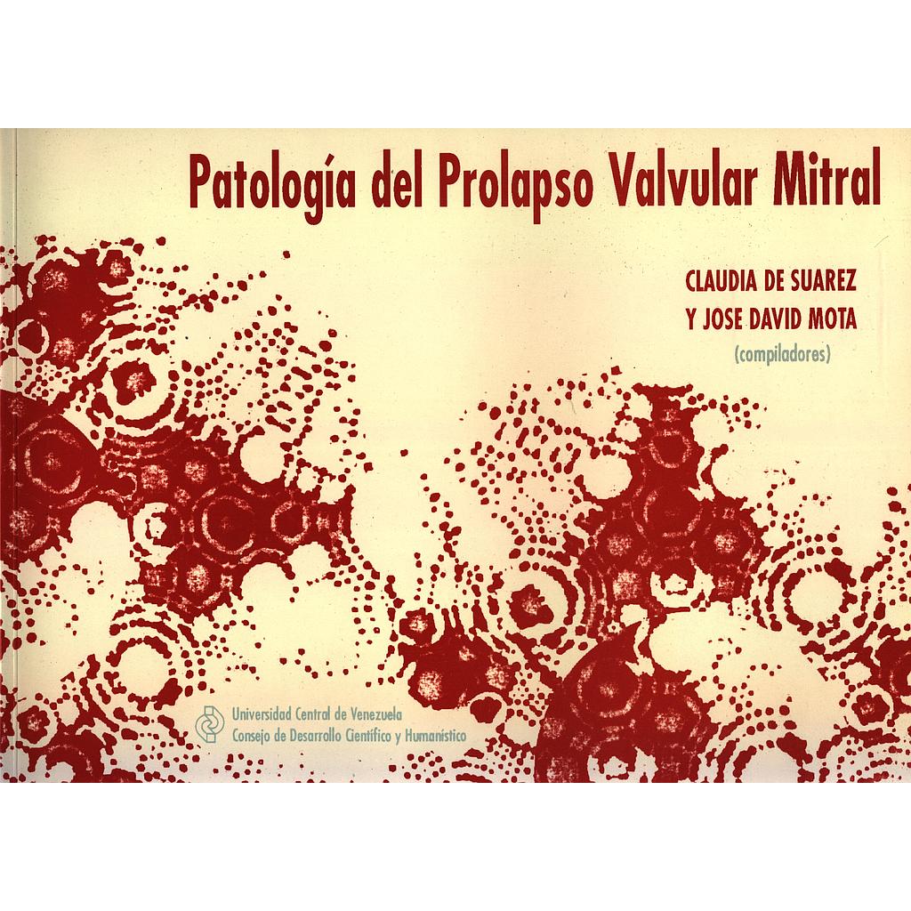 Patología del prolapso valvular mitral